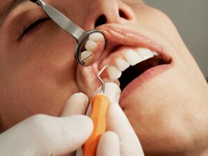 dental hygiene jobs in UK